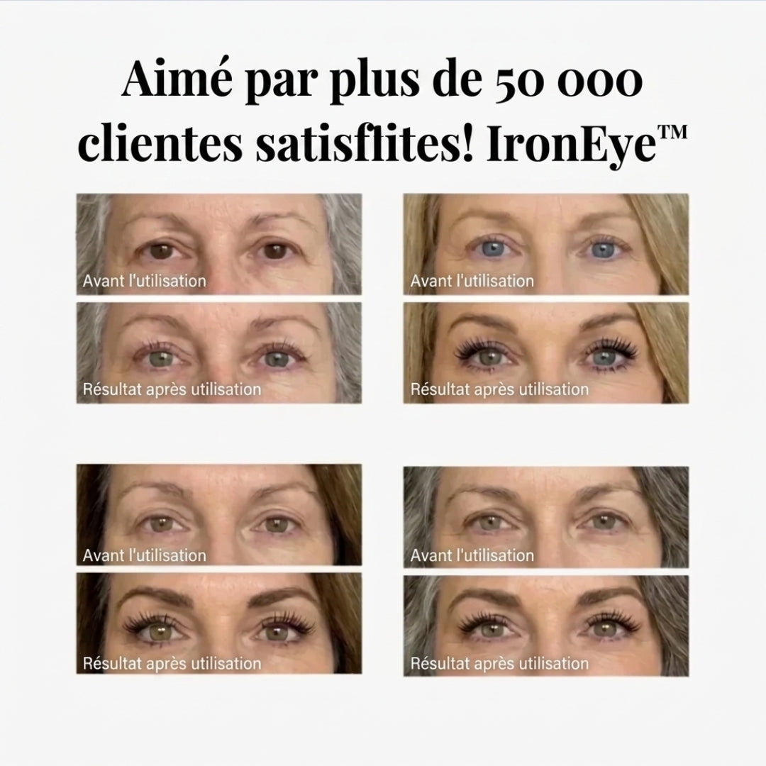 IronEye™
