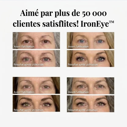 IronEye™