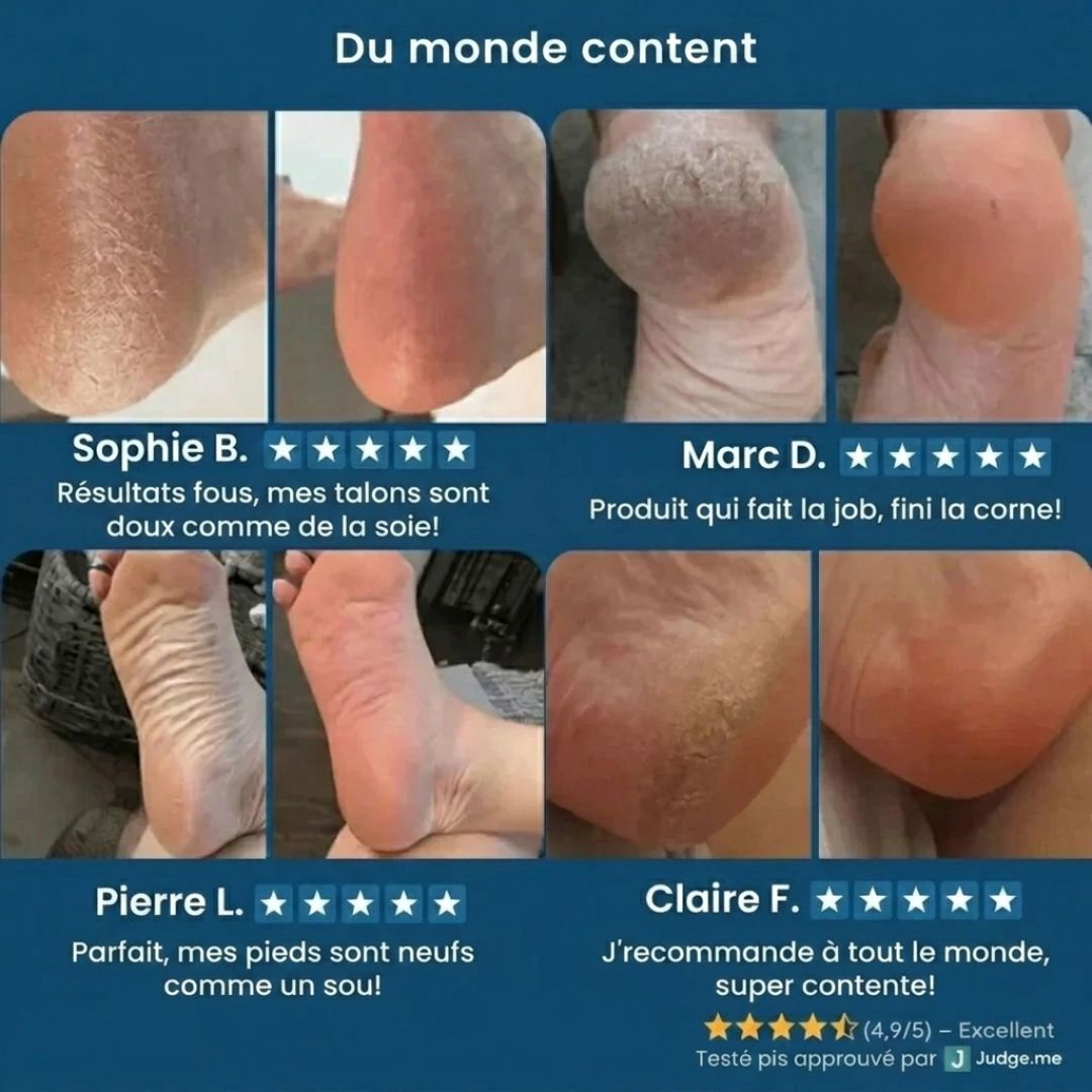 Rape Exfoliante Malin Québec – Râpe électrique